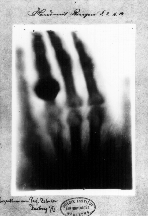 The Scientist Who Discovered the Device Turns Our Inside Out: Wilhelm Röntgen First X-Ray Image