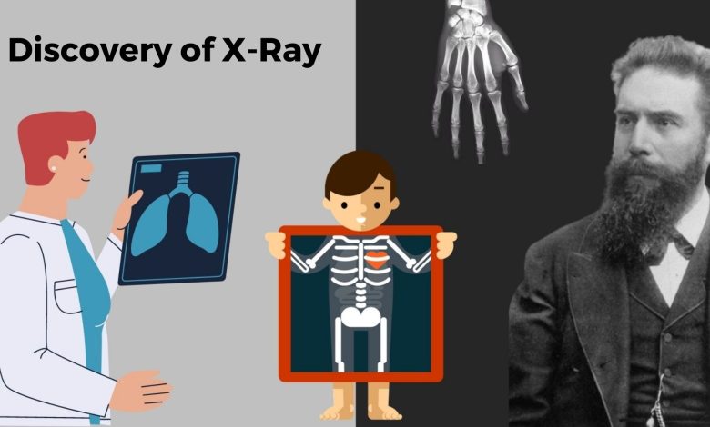 The Scientist Who Discovered the Device Turns Our Inside Out: Wilhelm Röntgen röntgen