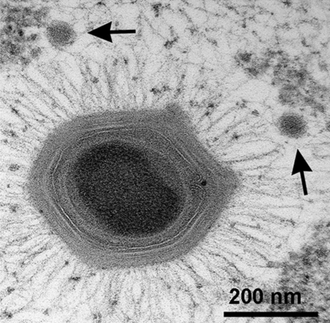 The Mystery of Viruses: The Thin Line Between Life and Non-Life The Mystery of Viruses: The Thin Line Between Life and Non-Life